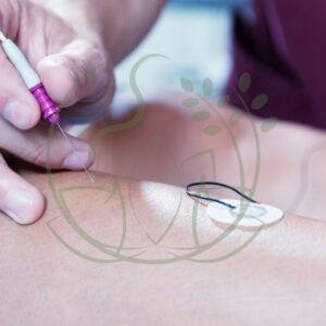 Masaje Neuromuscular